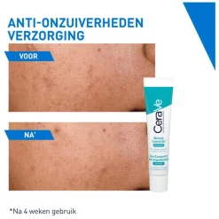 Clearance CeraVe Anti-Onzuiverheden Verzorging 40 ML
