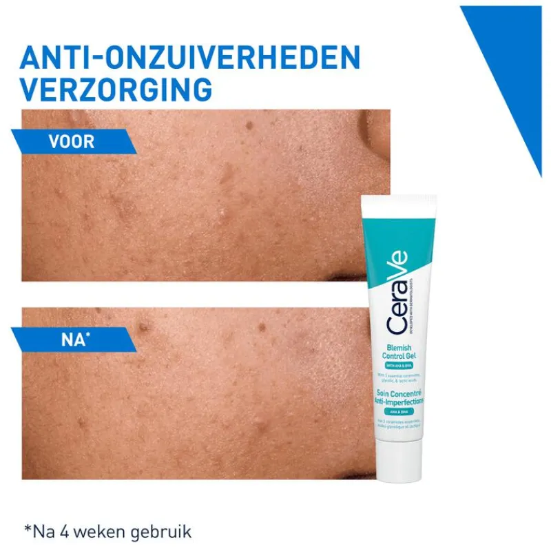 Clearance CeraVe Anti-Onzuiverheden Verzorging 40 ML