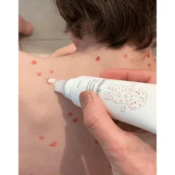 New donttellmum Waterpokken Behandeling 50 ML