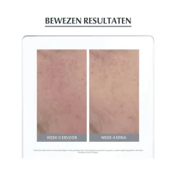 Hot Eucerin AntiREDNESS Corrigerende Crème 50 ML