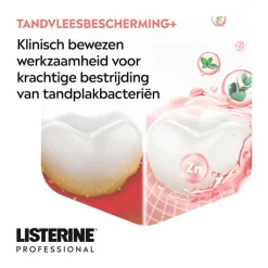 Online Listerine professional gum protection+500ml