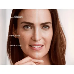 Hot NIVEA Cellular Luminous630 Anti-Pigment Serum 30 ML