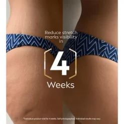 Outlet NIVEA Luminous630 Anti-Striae Lichaamsolie-serum 100 ML