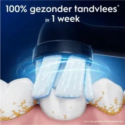 Hot Oral-B iO Gentle Care Opzetborstels Zwart 2 Stuks 26