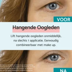 Best Remescar Hangende Oogleden Crème 8 ML