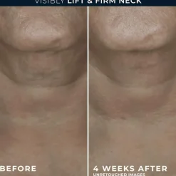 Outlet RoC Derm Correxion Contour Cream 50 ML