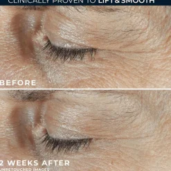 Hot RoC Derm Correxion Dual Eye 20 ML