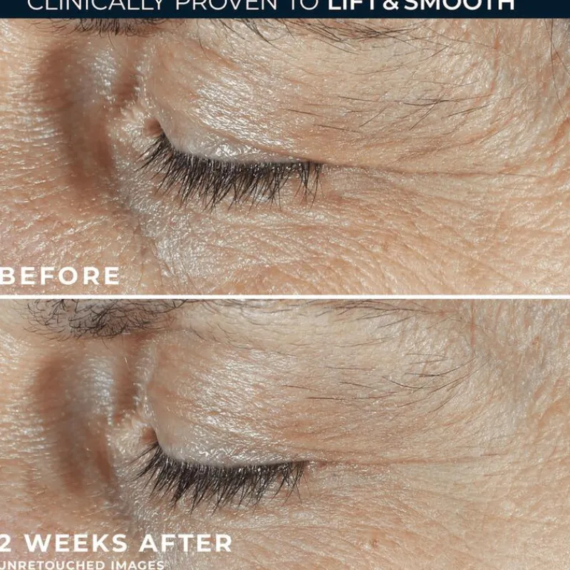 Hot RoC Derm Correxion Dual Eye 20 ML