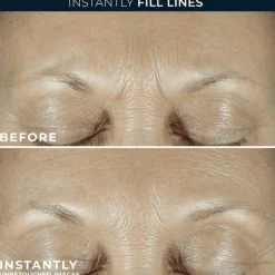 Best RoC Derm Correxion Fill + Treat Serum 15 ML