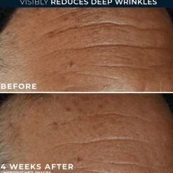 Best RoC Derm Correxion Fill + Treat Serum 15 ML