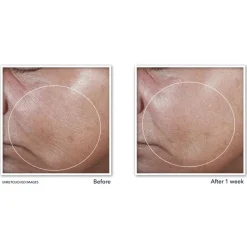 Outlet RoC Derm Correxion Firming Serum Stick