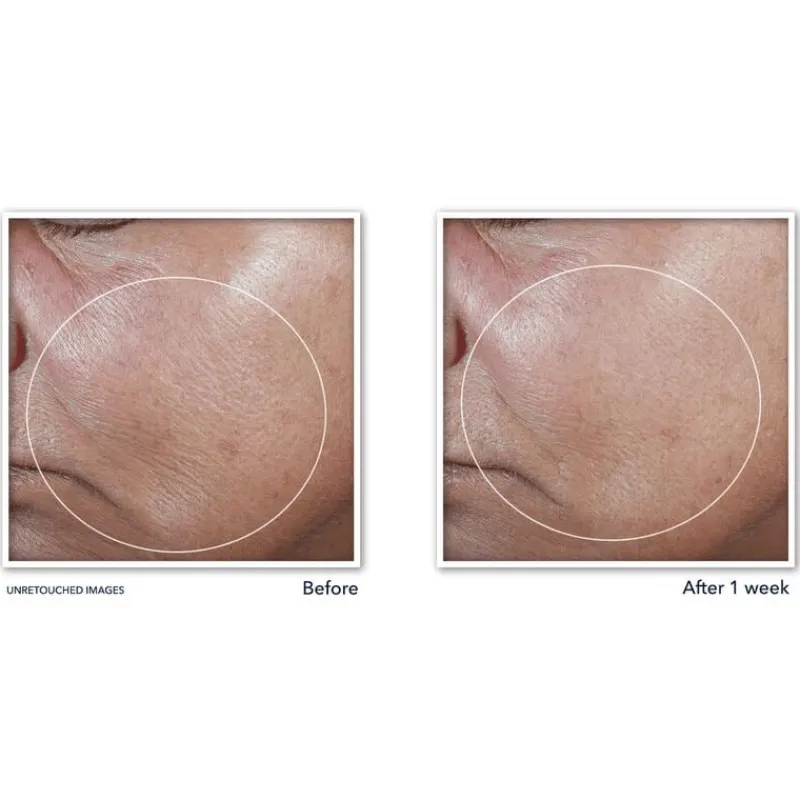 Outlet RoC Derm Correxion Firming Serum Stick