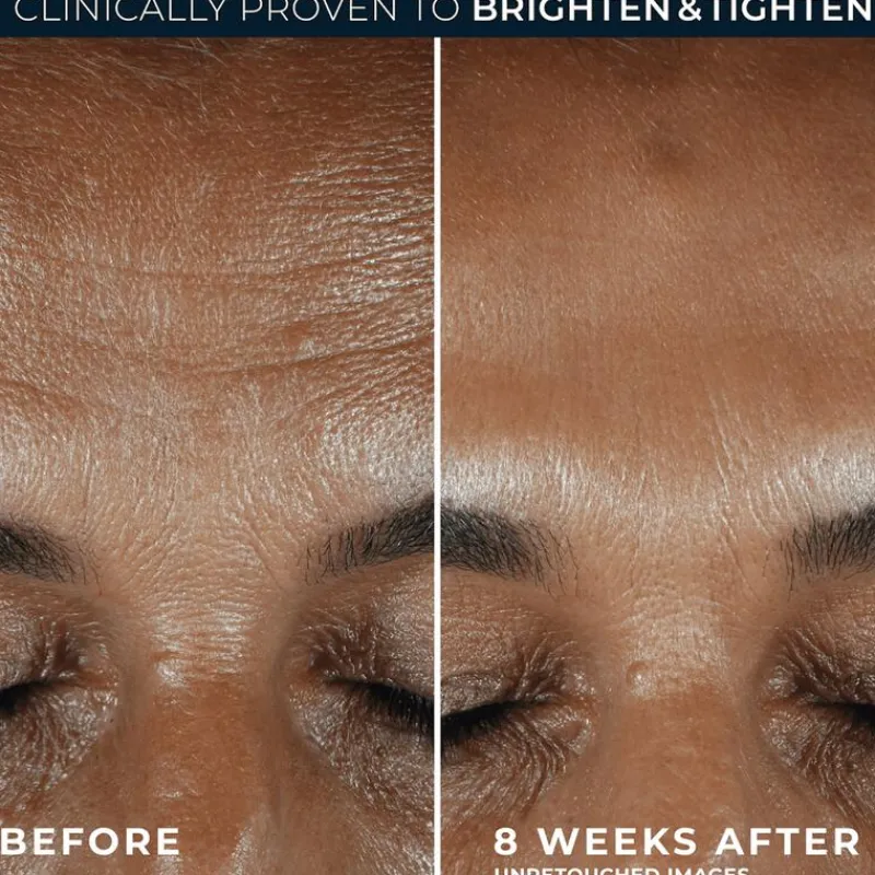 Outlet RoC Multi-Correxion Revive & Glow Daily Serum 30 ML