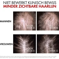 New Vichy Dercos Aminexil Regenerating Serum 90 ML