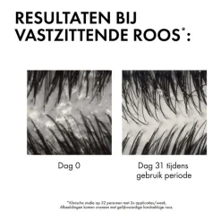 Vichy Dercos Anti-Roos DS Shampoo DH Navulling 390 ML