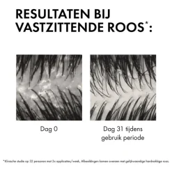 Clearance Vichy Dercos Anti-Roos DS Shampoo NH/VH Navulling 390 ML