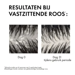 Best Vichy Dercos Anti-Roos Shampoo 200 ML